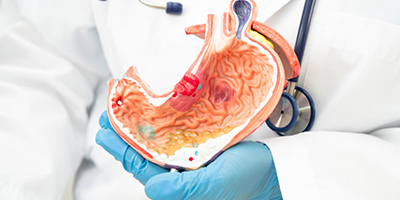 Gastroenterologist consulting patient for GERD treatment